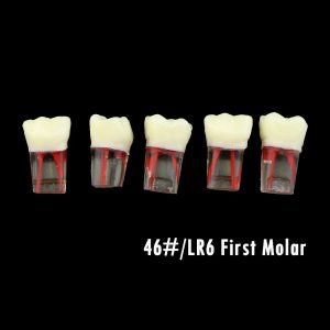 2 PCS Dental Endodontik Kök Kanal Modeli Döner Dosyalar Diş Çalışma Blokları Reçine Endo Eğitim RCT DEMO ÖĞRENCİ Uygulama Diş Hekimliği