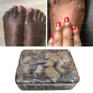 El yapımı sabun Afrika siyah sabun Melanin anti-yaşlanma karşıtı güzellik nemlendirici doğal banyo gövdesi tedavisi akne beyazlatıcı cilt bakımı 240416