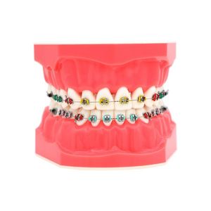 Braket Arch Wire Ligature Tie ile diğer Oral Hijyen Dental Ortodontik Model 1 1 Standart Boyut Diş Modeli Tipodont Demo Hastalar için Öğrenciler 230524