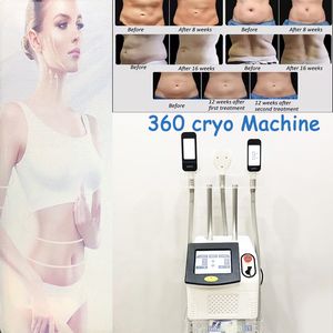 360 Yağ Donma Makinesi Kriyolipoliz Kriyo Kaynak Vakum Zayıflama Kilo Kaybı Yağ Azaltma Kriyoterapisi Liposuction Soğutma Teknolojisi