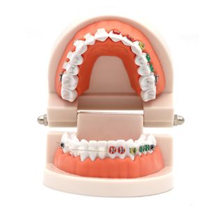 Другие гигиенические зубные ортодонтические модели лечения перорального ортодонтического обработки типодонт с орто -металлическим керамическим кронштейном арки -проволоки ортодонтической зубной зубной зубной протезы Модель 230617