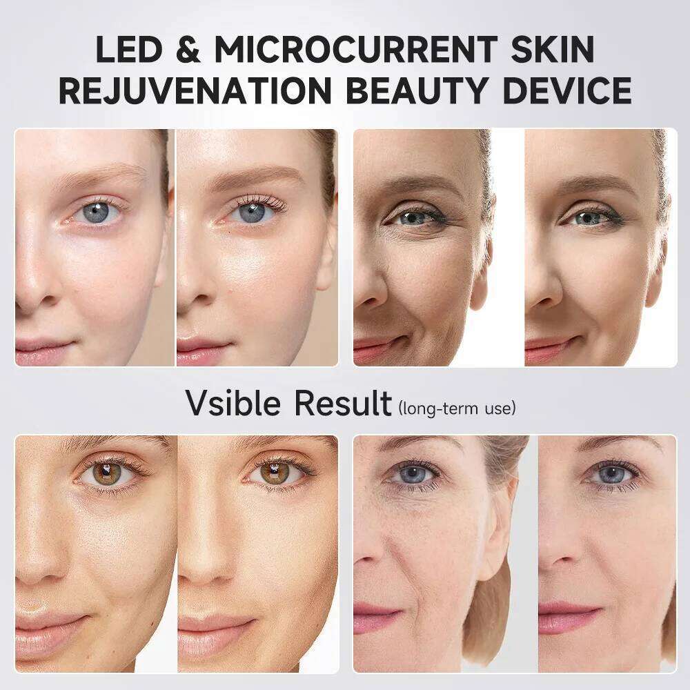 Ubilli Booster Pro Led Facial Therapy Beauty Wand Red Light Eye Massager For Skincare Rejuvenation Tool