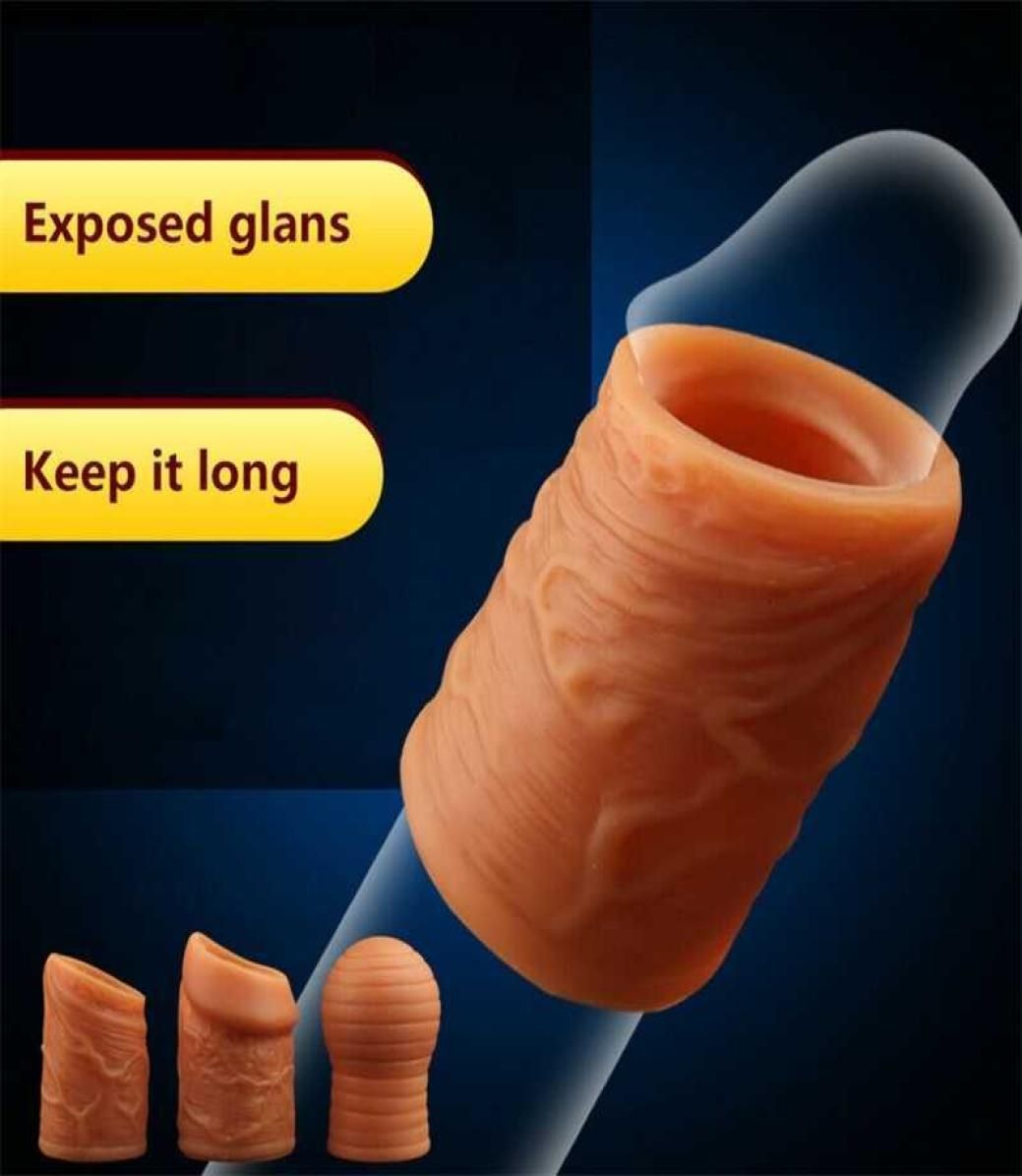 Foreskin Restoration Before After foreskin-restoration-before-after