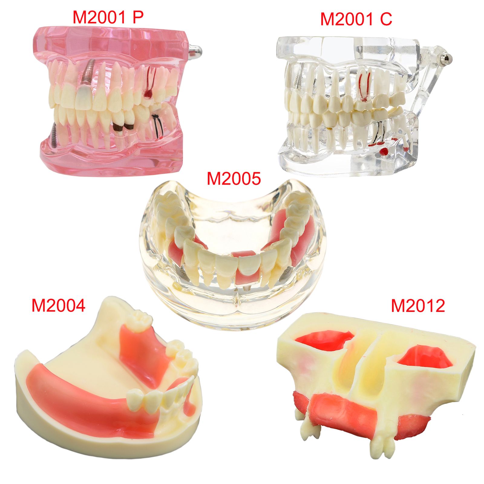 Modèle de dent dentaire pour l'enseignement du matériel dentaire Outils  dentaires