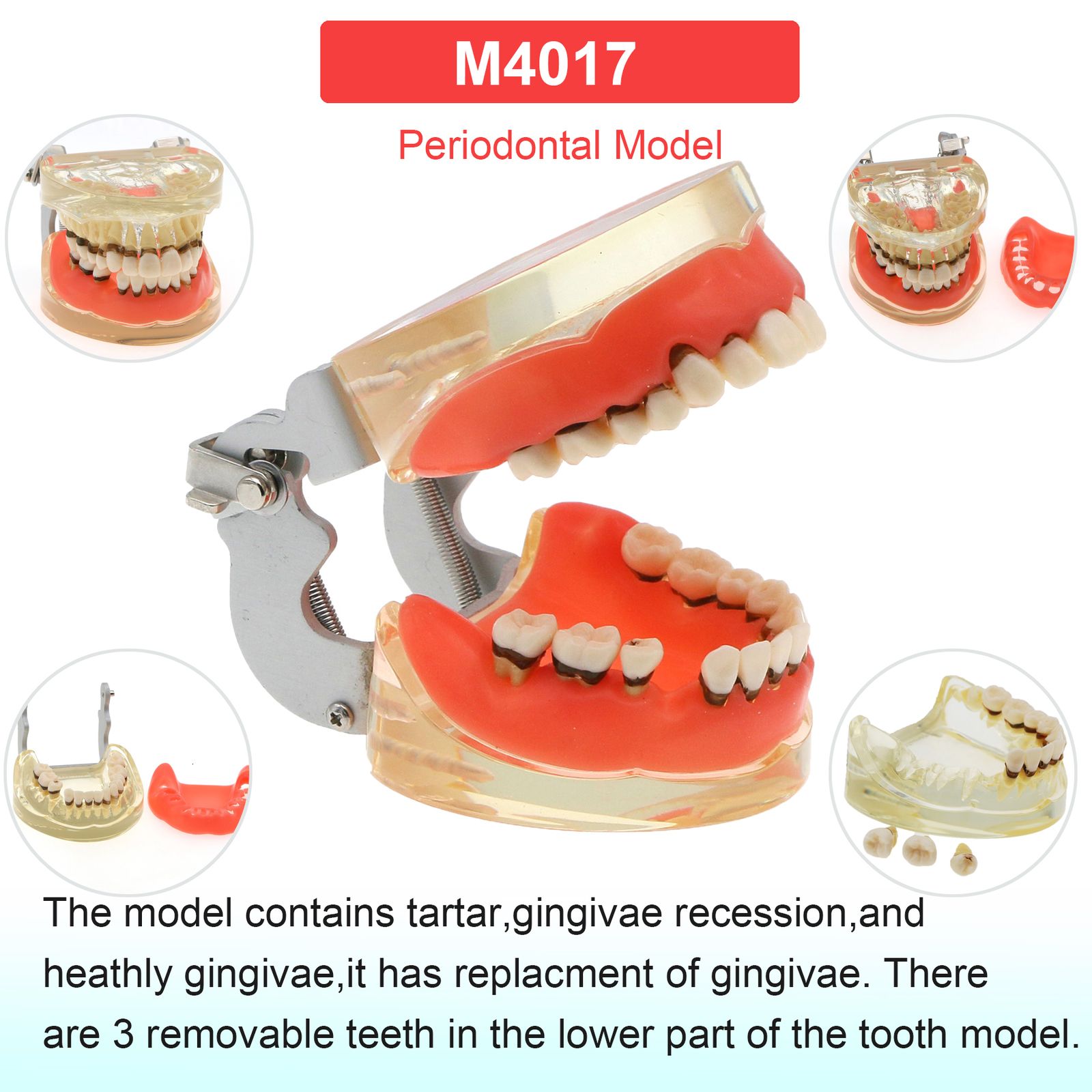 M4017