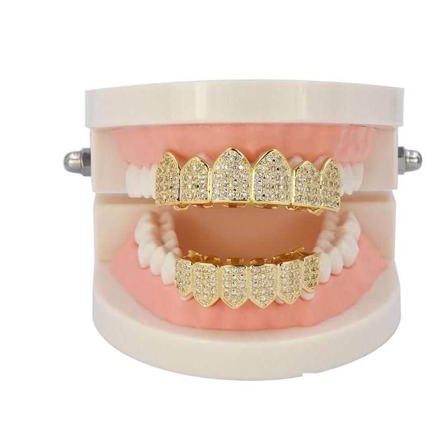 Dents supérieures d'or