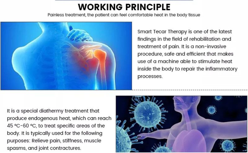 448KHZ Smart Tecar Therapy Machine Physiotherapists Practitioners Of Sport Aesthetic Medicine