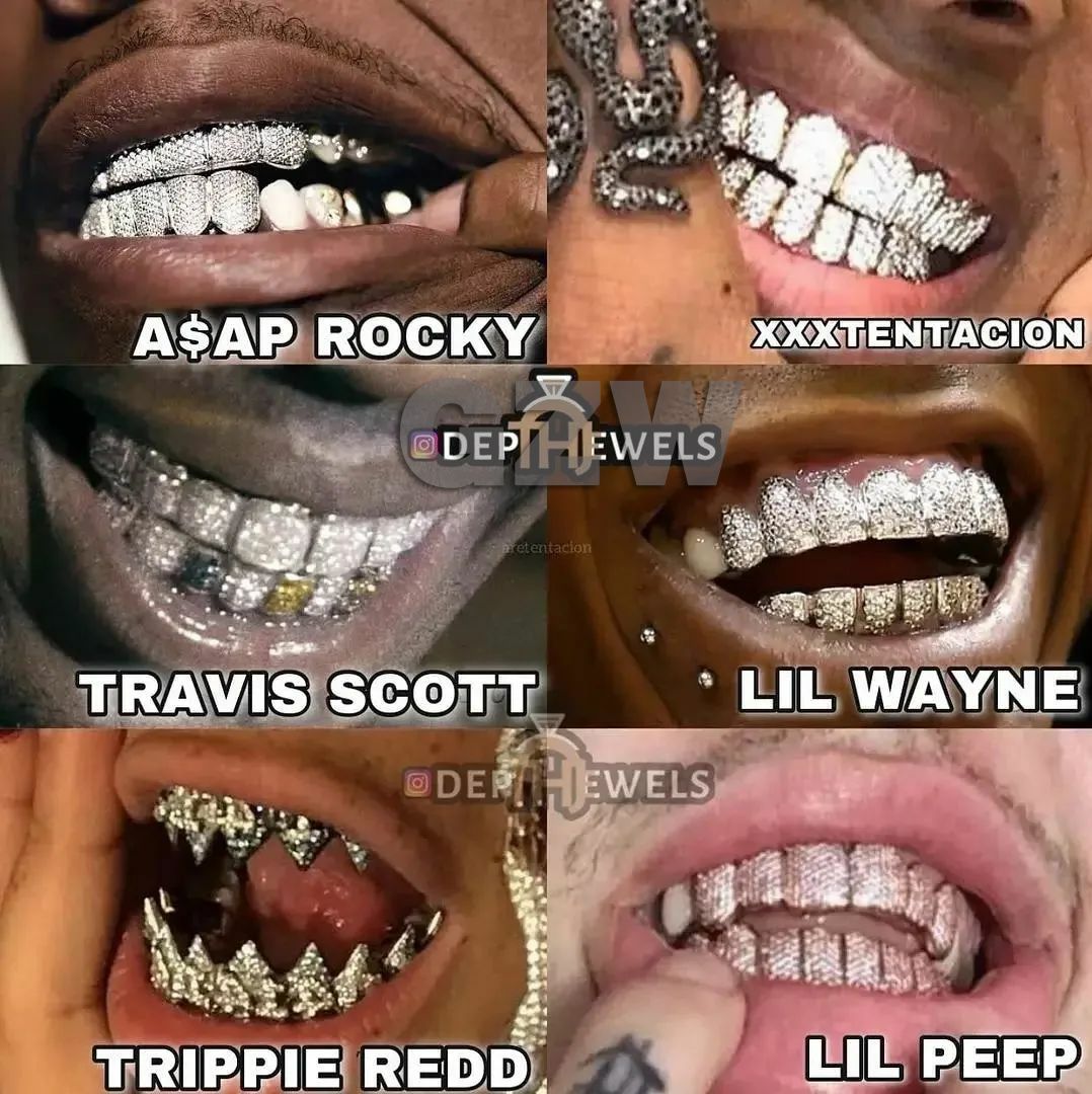 Gold Vampire Teeth Caps