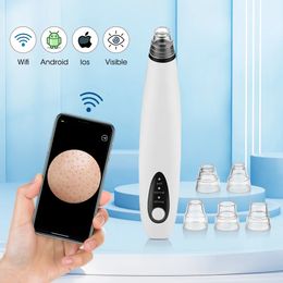 WiFi Camera Visual Face Blackhead Remover Vacuum Suction Pore Cleaner Deep Nose Cleasning Pimple Removal With 5 heads Tool 240106