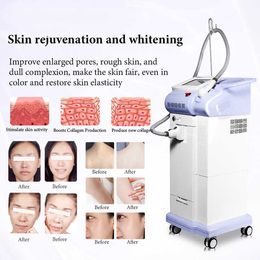 Laser Machine 1200W 2000W Portable 755nm 808nm 1064nm Eyebrow Hair Removal Q switch Nd Yag Tattoo Removal