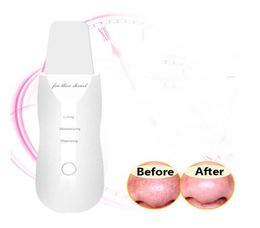 USB Rechargeable Ultrasonic Face Skin Scrubber Facial Cleaner Peeling Vibration Blackhead Removal Exfoliating Pore Cleaner Tools9241522