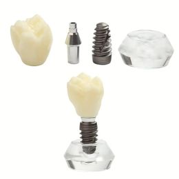 Single Tooth Crown Model Detachable Teeth Implant Demonstration Model Crystal Dentistry Teach Study Model For Dentist Clinics