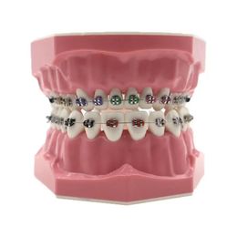 1pc Dental Orthodontic Teeth Model With Metal Bracket Tubes Study Demonstratio