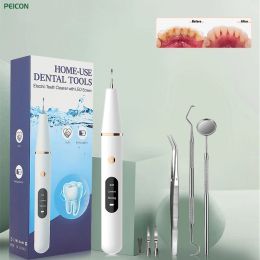 Irrigators Ultrasonic Dental Calculus Scaler for Teeth Electric Tartar Calculus Remover Plaque Stains Remover Dental Stone Removal with Led