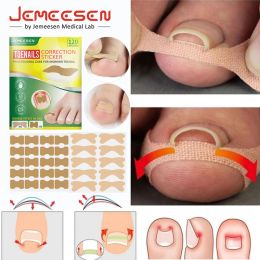 Tool Jemeesen Toenail Corrector Patch Ingrown Toenail Correction Stickers Paronychia Treatment Toe Thumb Nail Care Patches 120PCS