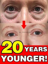 Eye Shadow Eye bag cream puffiness away work under eyes remove dark circlesL2403