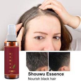 Treatments Turn Grey Hair Black Liquid Herbal Spray Hair Treatment Hair Growth Essence Oils Black Control Shampoo Moisturizing Hair 3/1PC