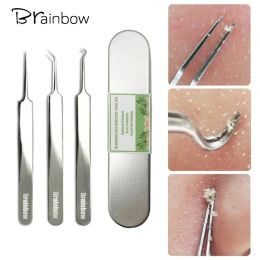 Removers Brainbow 3pcs Blackhead Tweezers Spot Cleaner Blackhead&Blemish Removers Blackhead&Comedone Acne Extractor Face Skin Care Tools