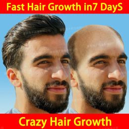 Products Fast Hair Growth Hair Follicle Treatment Hair Growth Seborrheic Alopecia Hairline Upward Postpartum Hair Loss Baldness Hair Loss