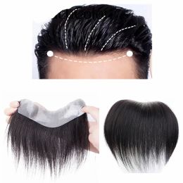 Toppers Frontal Hairpiece for Men Natural Black Hair Extension Hairline Loss Straight Tape in Human Hair Toupee Replacement System