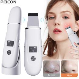 Instrument Ultrasonic Skin Scrubber Blackhead Remover Ultrasonic Peeling Pore Cleaner Face Cleaning Scrubber Ultrasonic Facial Espatula