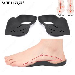 Large Size Insole For Flat Foot XO-Legs Flatfoot Orthotic O-shaped Legs Arch Support Plantar Fasciitis Shoes Orthotic Pad Unisex