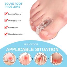 New Forefoot Pad Toe Splitter Thumb Valgus Corrector Hallux Valgus Corrector Overlap Adjuster Pain Relief Foot Care
