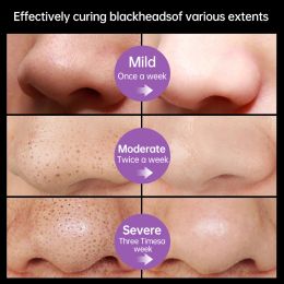 AUQUEST Black Dots Remover Face Mask Deep Cleansing Oil-Control Black Mask Acne Pimple Facial Treatment for Women Skin Care