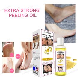 118ml/3.99fl.oz Yellow Peeling Oil Strong Exfoliating Peeling Oil Lighten Elbows Knees Hands Melanin Even Skin Tone Whiten Skin