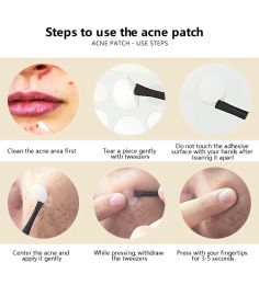 36Pcs Invisible Acne Patch Deep Cleansing Of Acne Pores Remover Pimple Patch Face Concealer Skin Care Make-up Cosmetics Tools