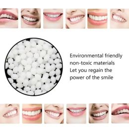 100g Temporary Tooth Repair Beads Missing Broken Teeth Dental Tooth Filling Material Food Grade FalseTeeth Solid Glue Denture