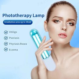 311nm UVB Lamp Ultraviolet Potherapy Instrument for the Treatment of Psoriasis Vitiligo White Spot Skin Disease 240430