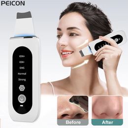 Ultrasonic Skin Scrubber Peeling Blackhead Remover Deep Face Cleaning Ion Ance Pore Cleaner Shovel Cleanser 240430