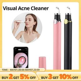Home Beauty Instrument Intelligent visual acne needle with 20X camera blackhead cleaning beauty tool facial extraction Q240507