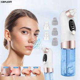 Home Beauty Instrument Electric blackhead removal vacuum bubble water circulation facial Hydro dead skin beauty acne cleaning machine