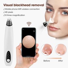 Home Beauty Instrument Visual Blackhead Remover Vacuum Facial Cleansing Acne Cleaner WIFI Micro Camera Black Spot Removal Skin Care Q240508