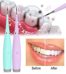 Tooth Cleaner Electric Ultra Dental Scaler Calculus Remover Whiten Stains Tartar Tool Whiten Teeth Remove253W4138259