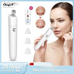 Cleaning Ckeyin Electric Blackhead Remover Adjustable Vacuum Facial Acne Cleaner Pimple Hole Cleaning Equipment Blackspot Skin Care Tool d240510