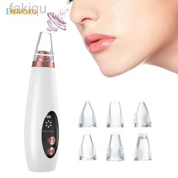 Cleaning Facial blackhead removal vacuum electric acne blackspot removal facial blackhead deep cleaning USB charger skin care d240510