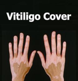 Vitiligo Concealer Liquid Pen Waterproof Vitiligo Patches Natural Hide Leukoderma Instant Makeup Covering Solution for Skin Diseas2736492