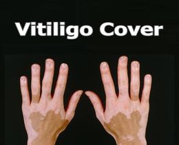 Vitiligo Concealer Liquid Pen Waterproof Vitiligo Patches Natural Hide Leukoderma Instant Makeup Covering Solution for Skin Diseas7862123