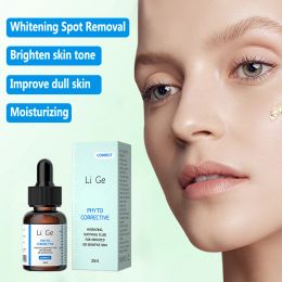 Freckles Removal Essence Remove Melasma Spots Remove Facial Spots Skin Dark Spot Whitening And Freckle Removing