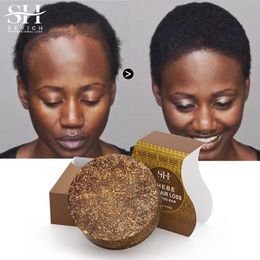 Africa Chebe Hair Shampoo Bar Anti Hair Loss Treatment Hair Regrowth Shampoo Soap Hair Growth Products Get Rid Of Wigs Sevich