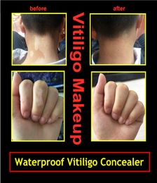 Waterproof Vitiligo Face Concealer Pen For Covering Hands Body Leukasmus White Spots Hide Skin Leukoderma Instant Makeup Liquid Pe5339279