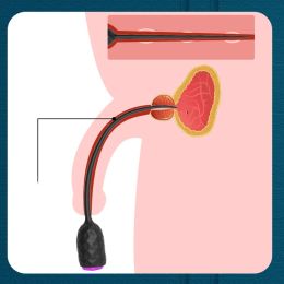 1pc 10 Speed Long Urethral Vibrator Catheter Penis Plug Sex Toys for Men Vibrating Urethra Sound Dilator Massager Dildo Vibrator