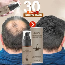 Powerful Hair Growth Serum Spray Ginger Anti Hair Loss Treatment Products Repair Nourish Hair Roots Fast Regrowth Men Women