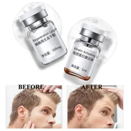 Products Hair Growth Products Stem Cell Serum Anti Hair Loss Repair Follicles Stimulation Hairline Fast Growth 2pcs/Set Hair Care Essence