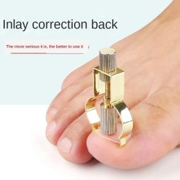 Tool Ingrown Toenails Correction Pedicure Foot Toe Nail Care Tools File Elastic Patch Straightening Clip Brace Corrector Wire Fixer