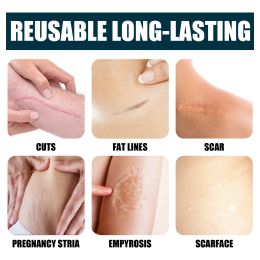 Advanced Scar Removal Cream Acne Pimples Stretch Marks Repair Gel Burn Surgical Scar Treatment Smoothing Body Beauty Skin Care