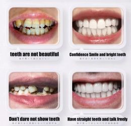 Sdotter Eco-friendly False Teeth Silicone Upper Lower smile Veneers Perfect Laugh Veneer Dentures Paste Fake Teeth Brace Tempora